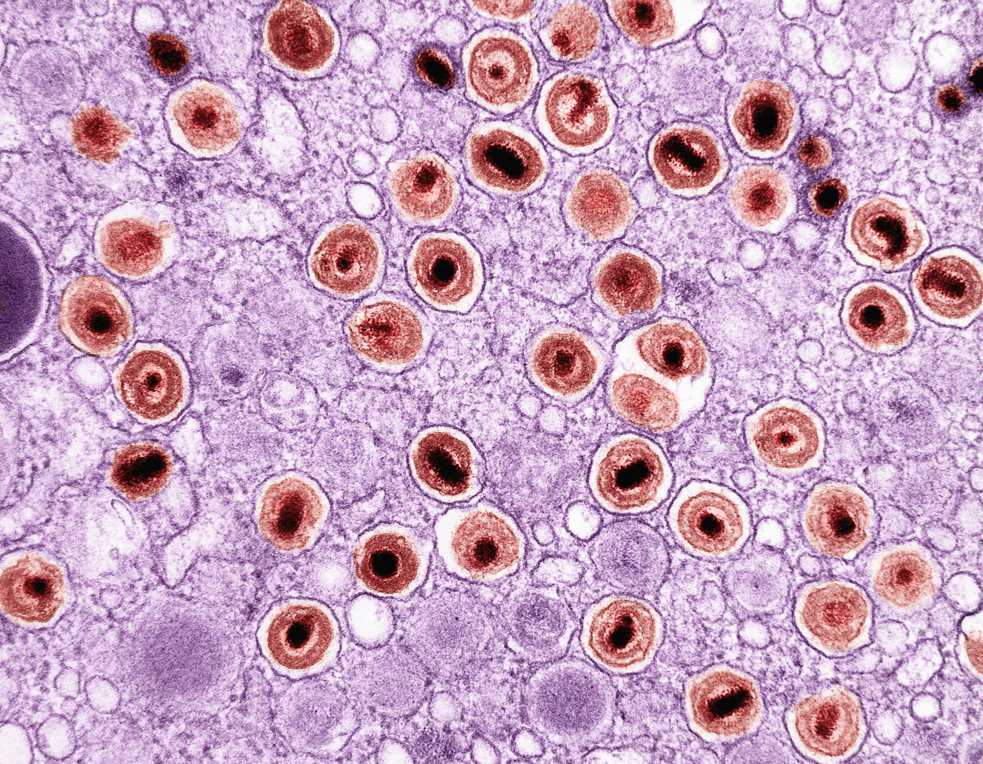 an image of a cell with blood cells in it